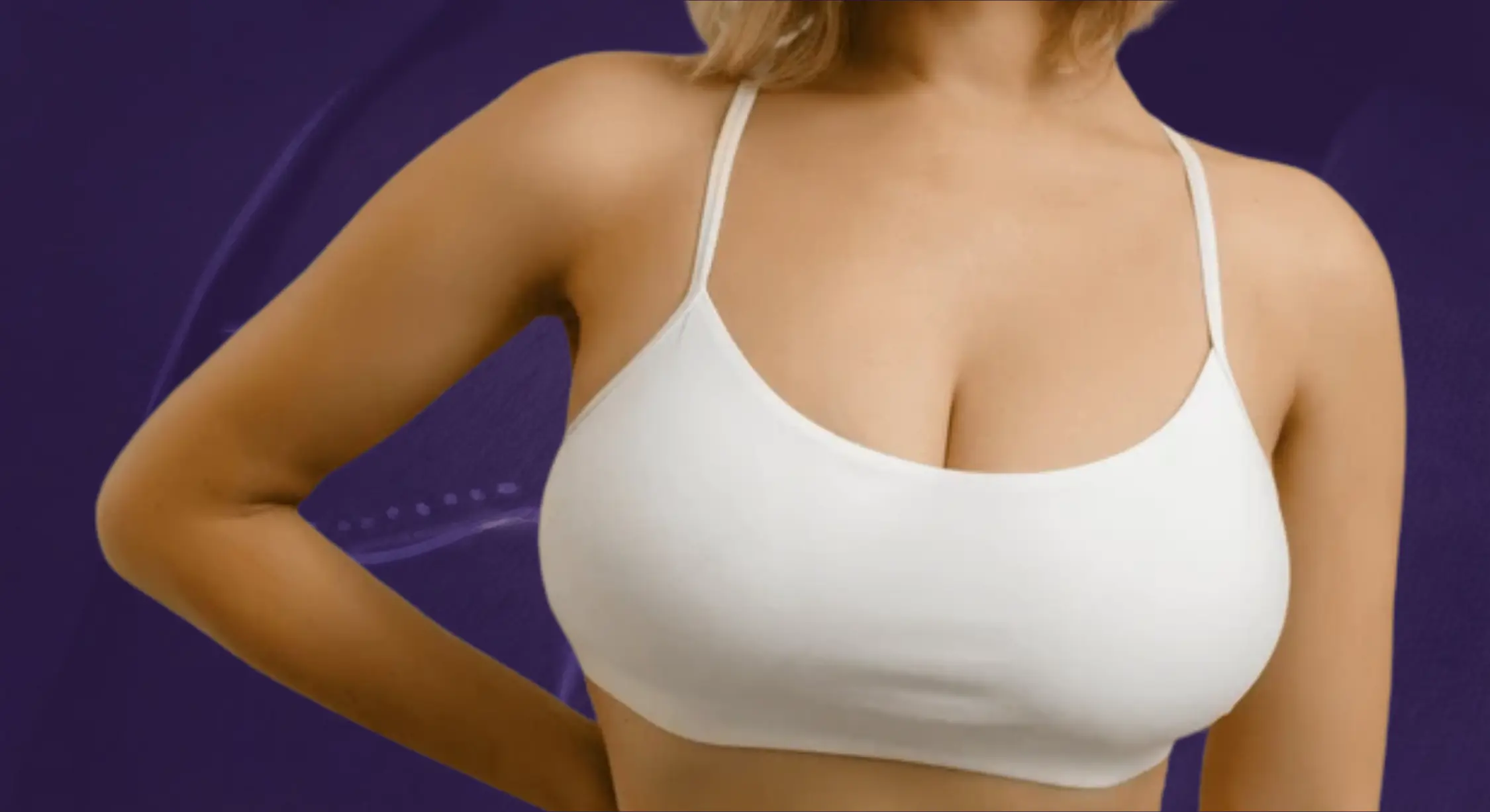 Breast Lift Mastopexy