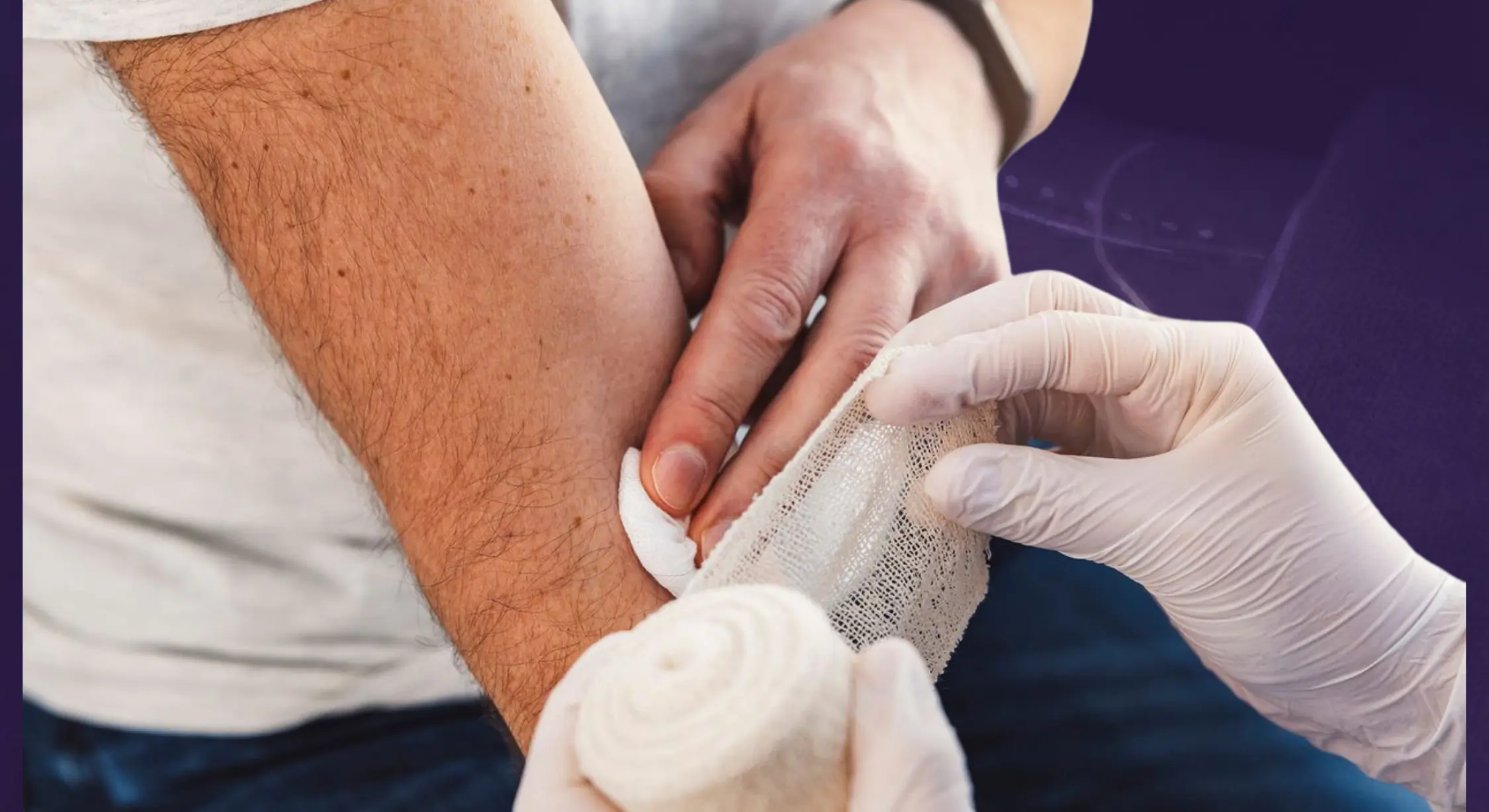 Burns and Trauma Reconstruction Surgery